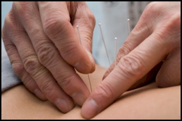 Annapolis Acupuncture